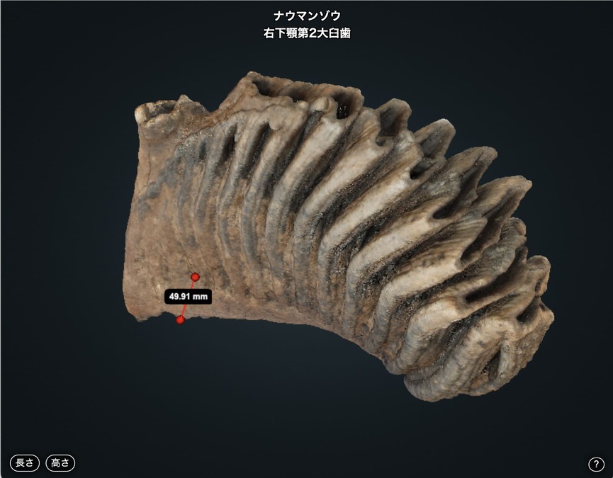 右下顎第2大臼歯