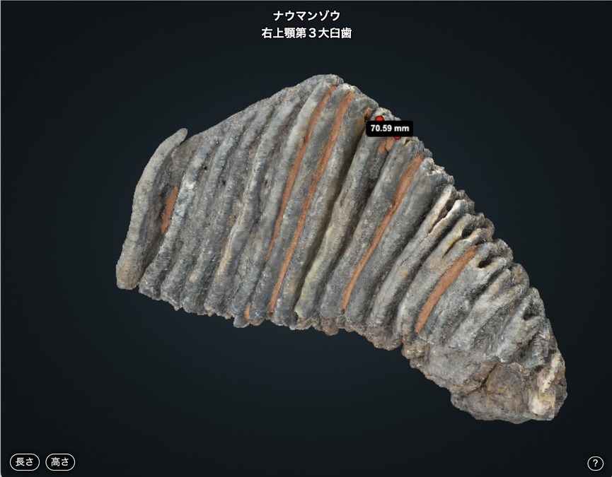 右上顎第3大臼歯