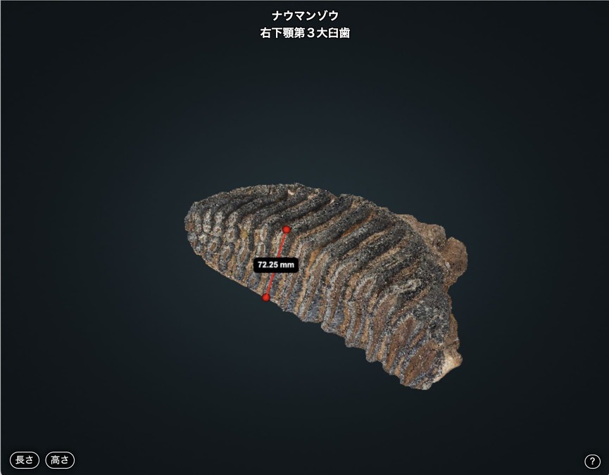 右下顎第3大臼歯